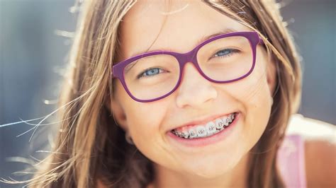 are braces cute|Common Questions About Braces Answered By Doctors..